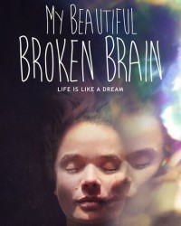 Phim Khối óc xinh đẹp tội nghiệp của tôi - My Beautiful Broken Brain (2016) Phim Khối óc xinh đẹp tội nghiệp của tôi - My Beautiful Broken Brain (2016)